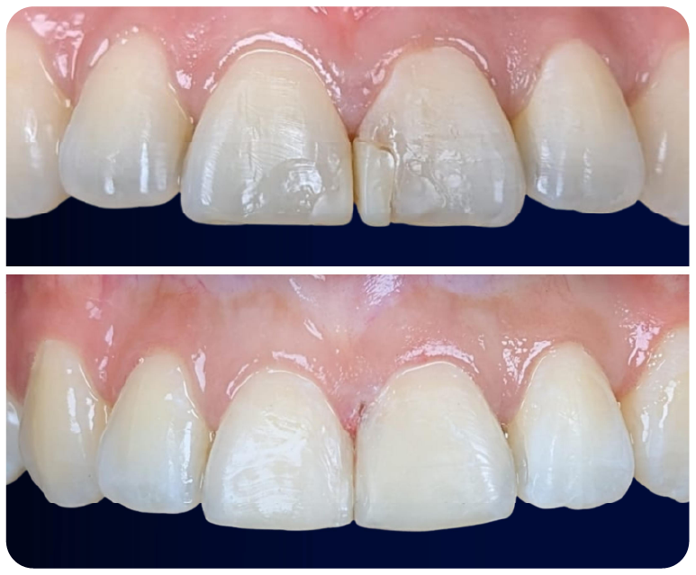 Ortodoncia preventiva